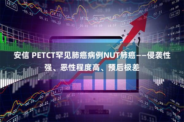 安信 PETCT罕见肺癌病例NUT肺癌——侵袭性强、恶性程度高、预后极差